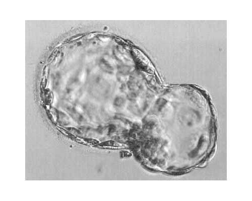 辽宁省2024年试管婴儿助孕费用明细与省钱技巧解析