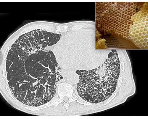 2025年温州试管婴儿医保报销政策详解及代生助孕指南