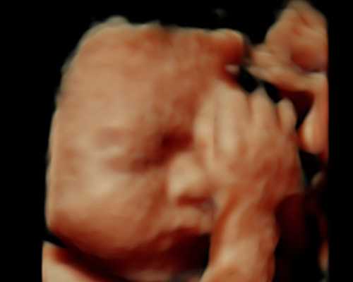 温州附二医院试管婴儿排名及成功率解析，助孕选择指南