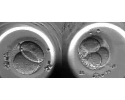 附二医三代试管技术评估与助孕选择指南