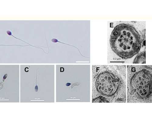 温州代怀基础检查与试管助孕费用解析，探讨供卵代生流程及代怀费用多少
